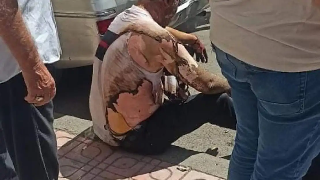 Diyarbakır'da aydınlatma panosunda patlama: 2 yaralı