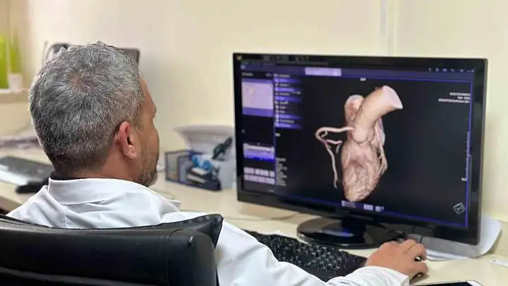 Diyarbakır'da kalp hastalıklarına hızlı teşhis!