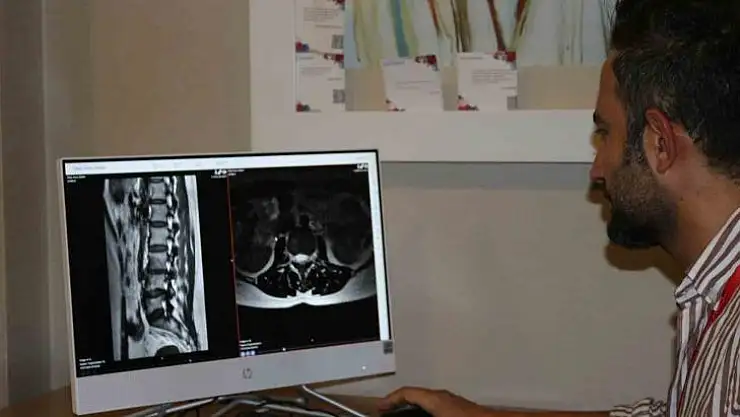 Uyurken seçilecek yastığa dikkat: Boyun fıtığı oluşabilir